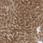 Immunohistochemical staining of human liver shows strong cytoplasmic positivity in hepatocytes.