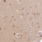 Immunohistochemical staining of human Cerebral cortex shows moderate cytoplasmic positivity in neuronal cells.