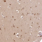 Immunohistochemical staining of human Cerebral cortex shows moderate cytoplasmic positivity in neuronal cells.