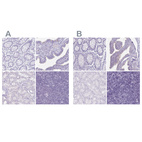 Immunohistochemical staining of human colon, fallopian tube, kidney and lymph node using Anti-ENKUR antibody HPA037593 (A) shows similar protein distribution across tissues to independent antibody HPA037594 (B).