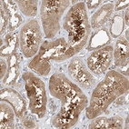 Anti-INPP4B Antibody