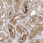 Immunohistochemical staining of human Kidney shows moderate cytoplasmic positivity in cells in tubules.