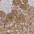 Immunohistochemical staining of human kidney shows strong cytoplasmic positivity in cells in tubules.
