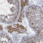 Immunohistochemical staining of human testis shows strong granular cytoplasmic positivity in Leydig cells.