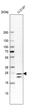 Western blot analysis in human cell line U-2197.