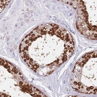 Immunohistochemical staining of human testis shows strong cytoplasmic positivity in cells in seminiferous ducts.