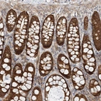 Immunohistochemical staining of human Colon shows moderate cytoplasmic positivity in glandular cells.