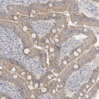 Immunohistochemical staining of human duodenum shows moderate cytoplasmic positivity in glandular cells.