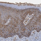 Immunohistochemical staining of human skin shows moderate positivity in cytoplasm in squamous epithelial cells.