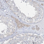 Immunohistochemical staining of human testis shows moderate cytoplasmic positivity in Leydig cells.