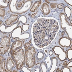 Immunohistochemical staining of human kidney shows moderate granular cytoplasmic positivity in cells in tubules.