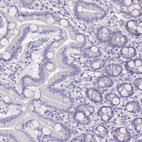 Anti-DDX4 Antibody