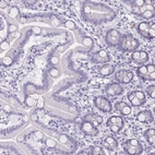 Immunohistochemical staining of human duodenum shows no cytoplasmic positivity in glandular cells as expected.