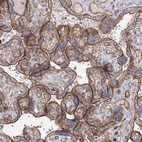 Anti-ZFYVE28 Antibody