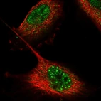 Anti-ZNF551 Antibody