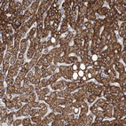 Anti-ANGPTL3 Antibody