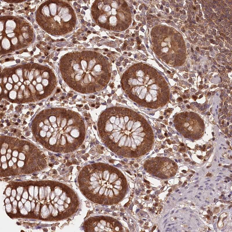 Anti-NPRL2 Antibody