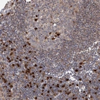 Anti-WDR75 Antibody