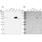 Western blot analysis using Anti-SUOX antibody HPA038208 (A) shows similar pattern to independent antibody HPA038209 (B).