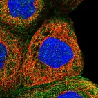 Immunofluorescent staining of human cell line A-431 shows localization to plasma membrane & cytosol.