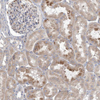 Immunohistochemical staining of human kidney shows moderate cytoplasmic positivity in cells in tubules.