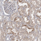 Immunohistochemical staining of human kidney shows moderate cytoplasmic positivity in cells in tubules.