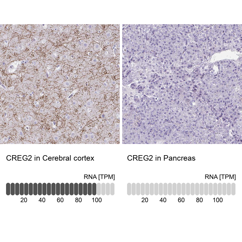 Anti-CREG2 Antibody