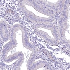 Immunohistochemical staining of human endometrium shows no positivity in glandular cells as expected.