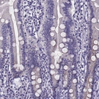 Immunohistochemical staining of human duodenum shows no positivity in glandular cells as expected.