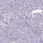 Immunohistochemical staining of human pancreas shows low expression as expected.