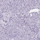 Immunohistochemical staining of human pancreas shows low expression as expected.