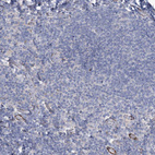 Immunohistochemical staining of human tonsil shows no positivity in non-germinal center cells as expected.