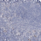 Immunohistochemical staining of human tonsil shows no positivity in non-germinal center cells as expected.