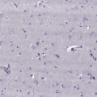 Immunohistochemical staining of human cerebral cortex shows no positivity in neurons as expected.