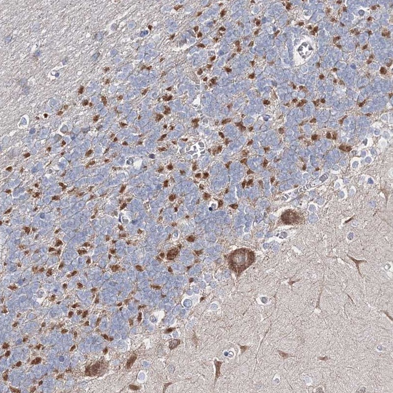Anti-ARHGAP32 Antibody
