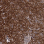 Anti-TBC1D9B Antibody