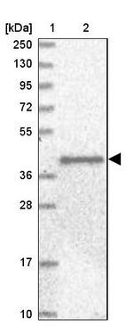 Lane 1: Marker [kDa] 250, 130, 95, 72, 55, 36, 28, 17, 10_br/_Lane 2: Human cell line RT-4