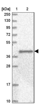 Anti-ANGPTL3 Antibody