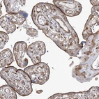 Immunohistochemical staining of human placenta shows moderate to strong membranous positivity in trophoblastic cells.