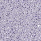 Anti-IZUMO1 Antibody