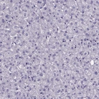 Immunohistochemical staining of human liver shows no positivity in hepatocytes as expected.