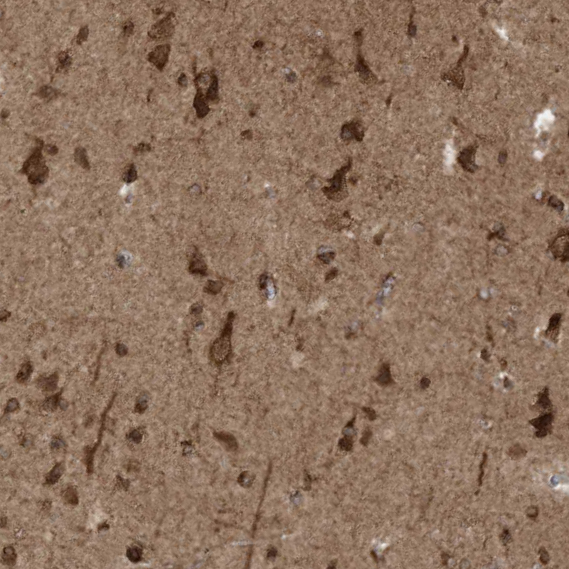 Anti-TRIM67 Antibody