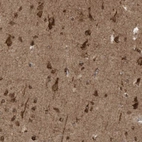 Anti-TRIM67 Antibody