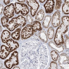 Anti-TBC1D7 Antibody