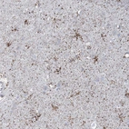 Immunohistochemical staining of human cerebral cortex shows moderate to strong granular positivity in neuropil.