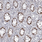 Anti-ZC3H8 Antibody