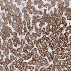 Immunohistochemical staining of human liver shows moderate to strong granular cytoplasmic positivity in hepatocytes.