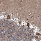 Anti-MAPK8IP2 Antibody