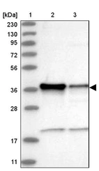 Lane 1: Marker [kDa] 230, 130, 95, 72, 56, 36, 28, 17, 11_br/_Lane 2: Human cell line RT-4_br/_Lane 3: Human cell line U-251MG sp