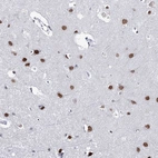 Anti-ZC3H8 Antibody